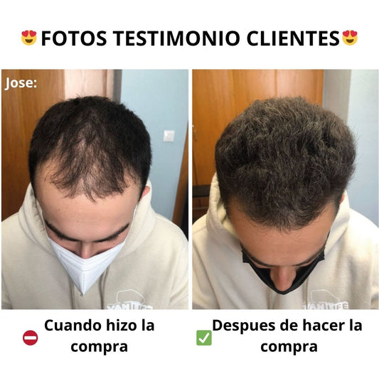 Tónico Capilar HAiR BOOXTER Premium + Obsequio